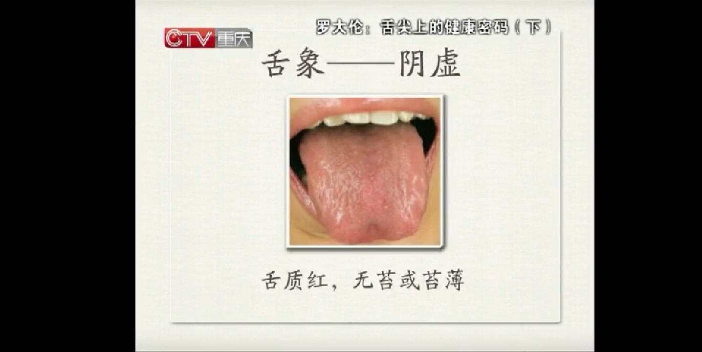 罗大伦医生舌诊的做法 步骤10