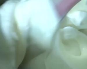 宝宝爱吃的酸奶溶豆（详细版）的做法 步骤9