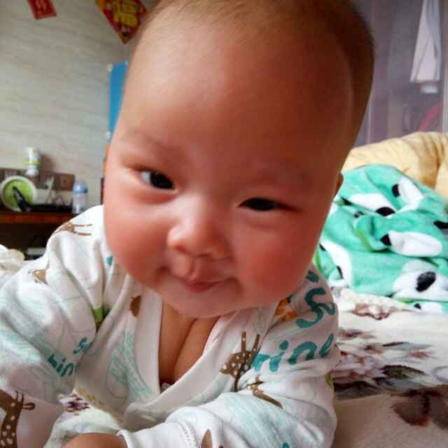 �头顶长西瓜�