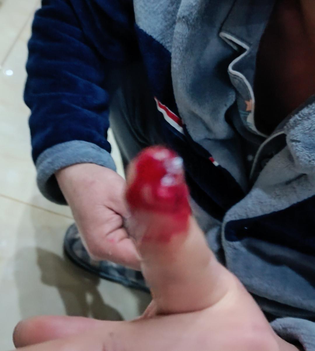 黑鱼汤