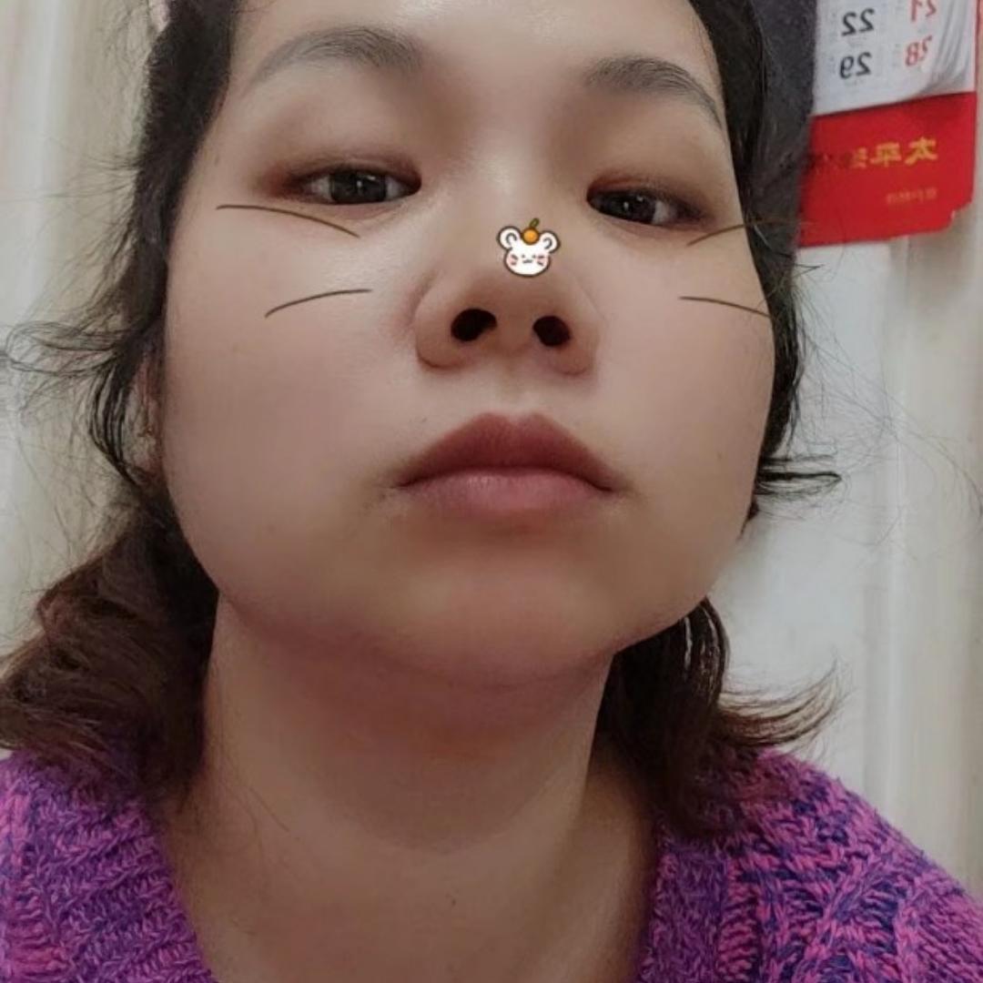 清橙CE