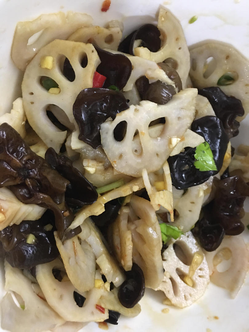 爽口开胃小凉菜 l 酸辣藕片