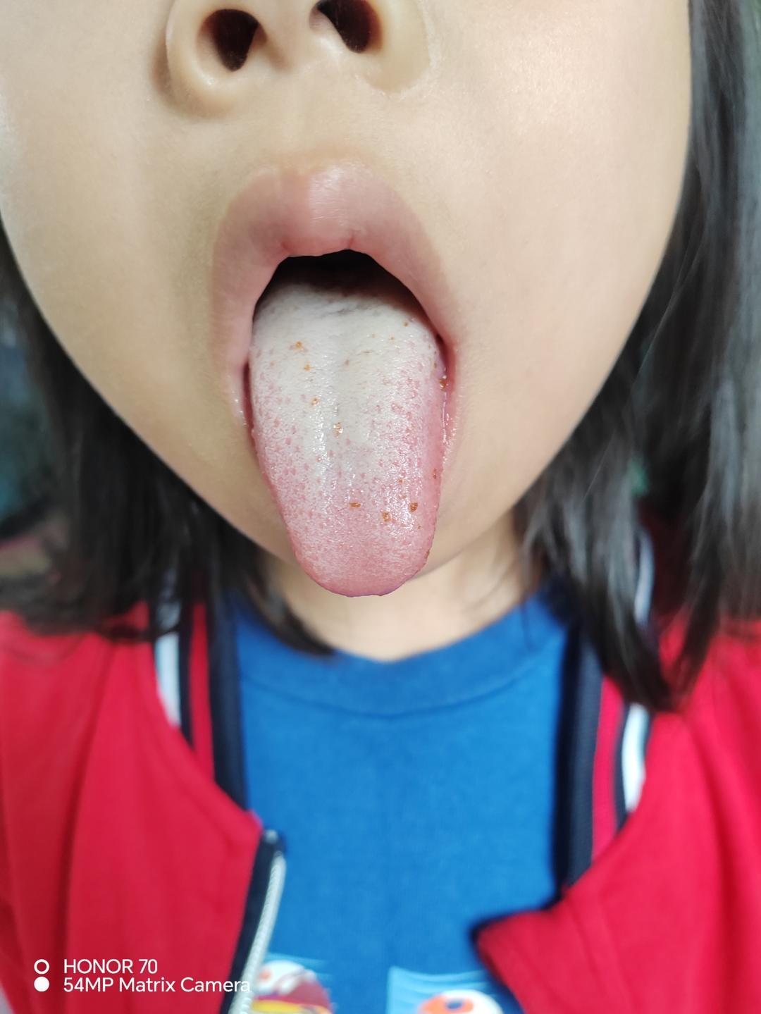 这个糙米油绝了，坚持喝了3个月