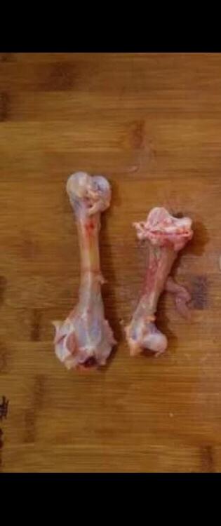 祖传秘方一骨折，骨刺恢复方