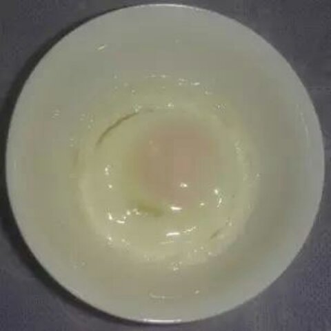 治感冒的蒸鸡蛋