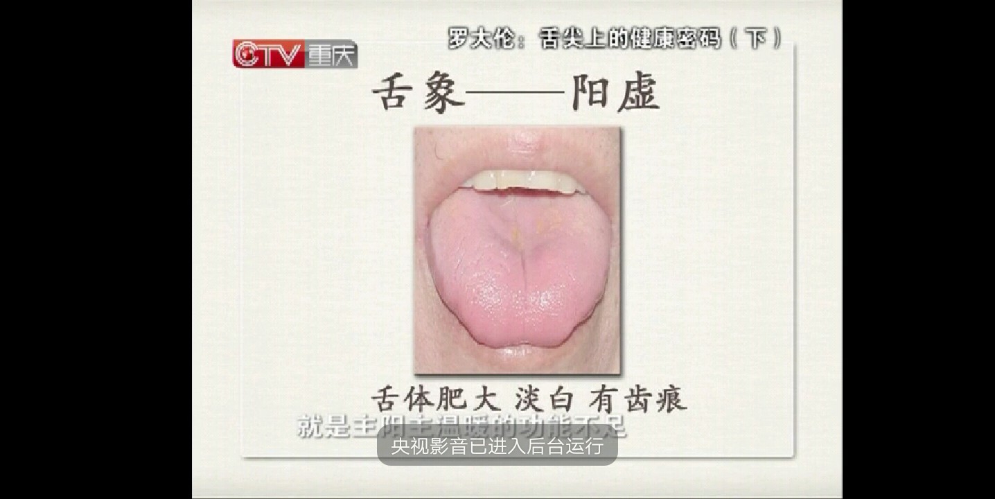 罗大伦医生舌诊的做法 步骤12