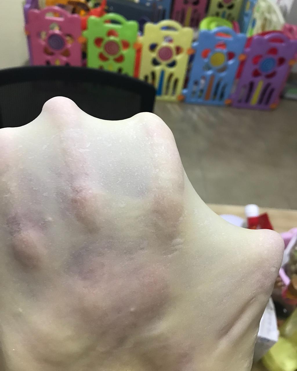 我的手揉膜历程