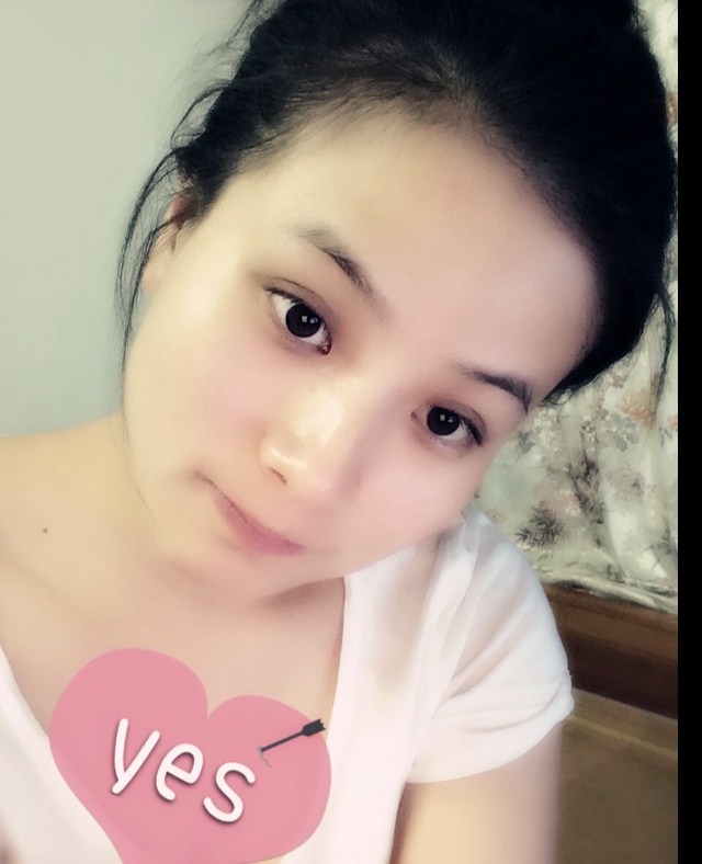 暧上黒眼圏