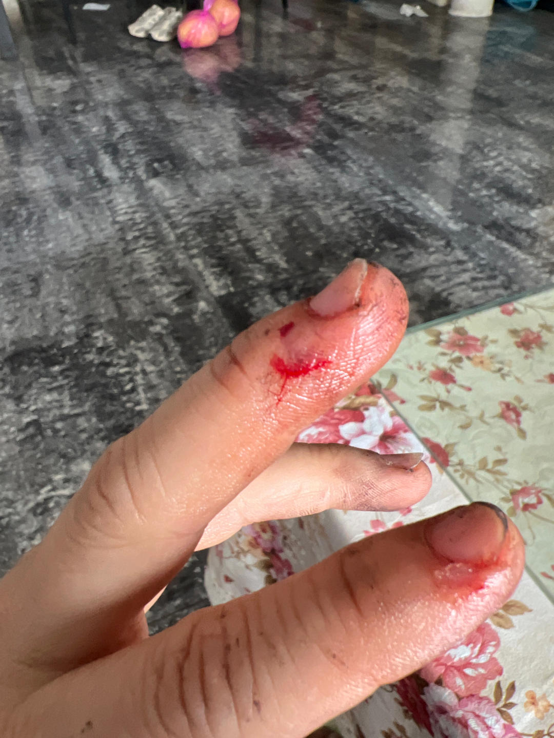 益气健脾的菱角这样剥最简单