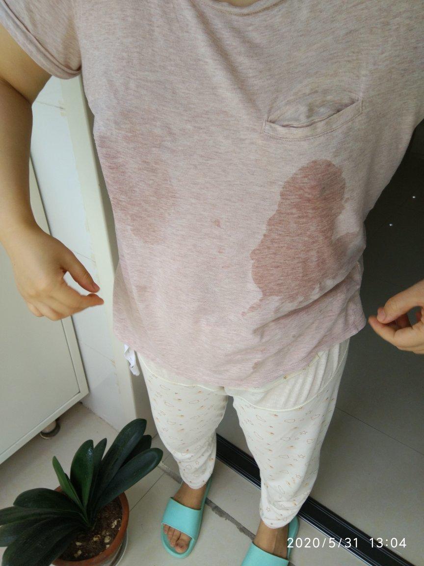 补气血丰胸汤（哺乳期催奶）