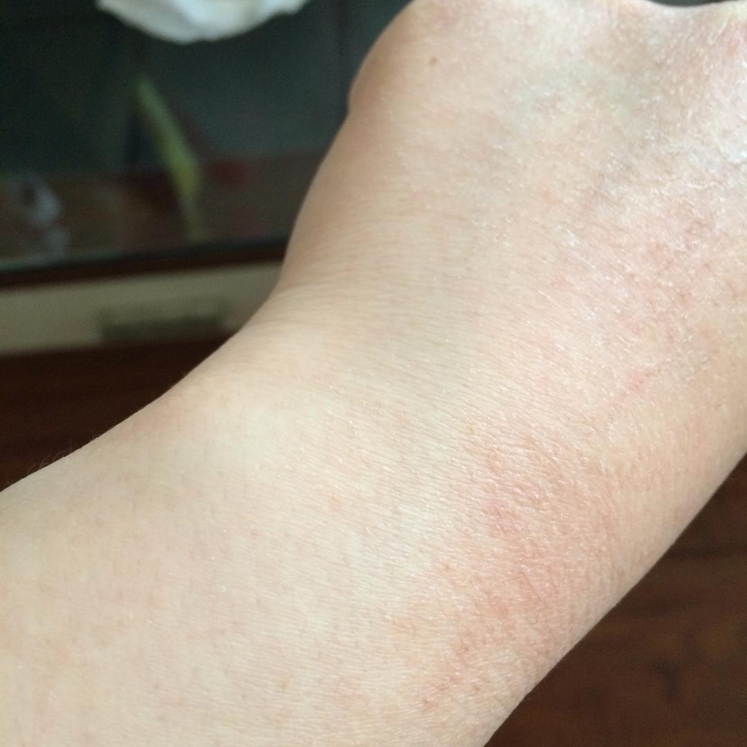 面粉过敏的反复折磨😭